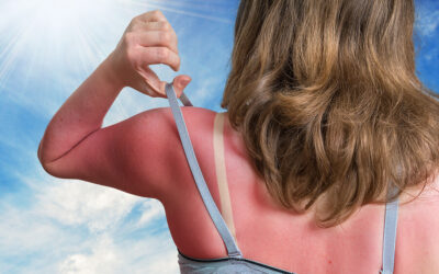 Summer Health The Wellness Way: Protecting Your Family Naturally All Season Long